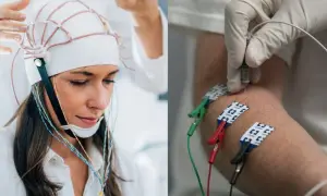 Przygotowanie do badania EEG głowy. Po prawej stronie igła wkłuwana do ramienia, co sugeruje badanie EMG.