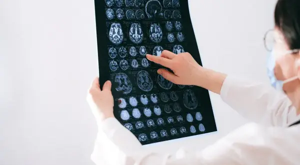 Zarobki neurologa w Polsce: mediana, widełki i kluczowe czynniki