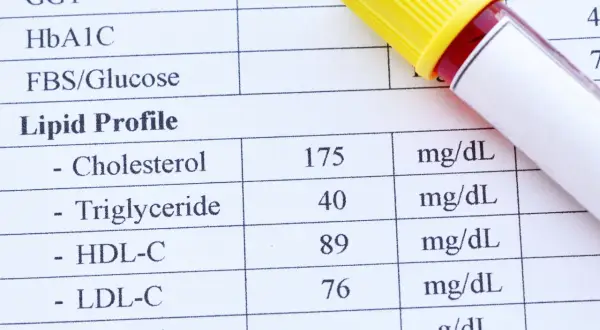 Lipidogram: Klucz do zdrowego serca? Zrozum swoje wyniki