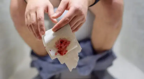 Krew utajona w kale: FIT czy gFOBT? Przygotuj się dobrze!