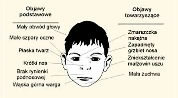 DDA objawy: Jak rozpoznać syndrom dziecka alkoholika i zacząć żyć?