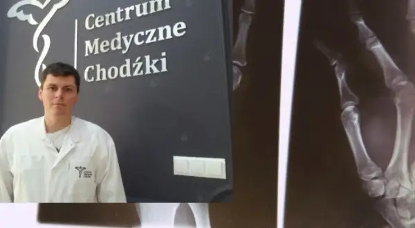 Lekarz w białym fartuchu na tle logo Centrum Medyczne Chodźki i zdjęcia rentgenowskiego dłoni.