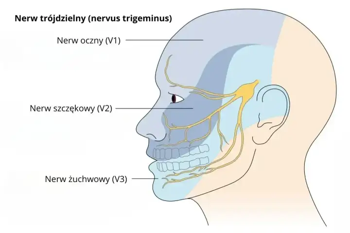 Schematyczny rysunek głowy z zaznaczonymi obszarami unerwienia nerwu trójdzielnego: nerw oczny (V1), szczękowy (V2) i żuchwowy (V3).